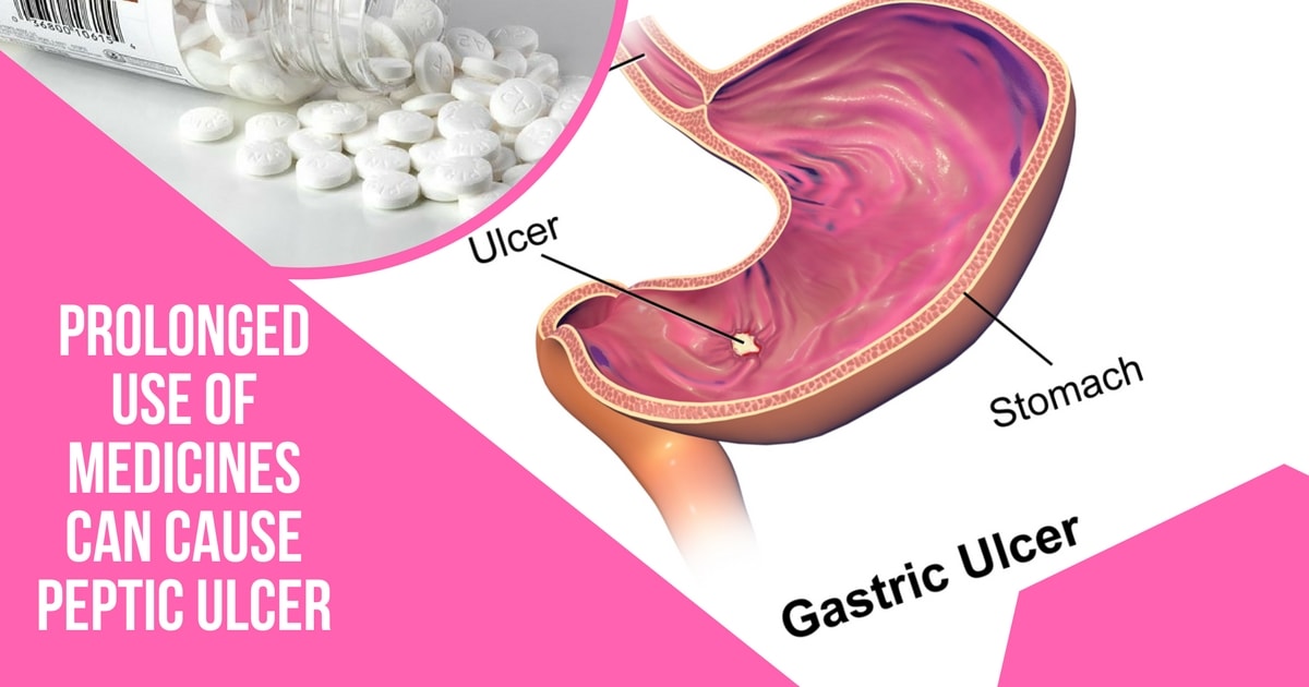 The Link Between Nsaid Medications And Peptic Ulcer Dr Maran Springfield Wellness Centre