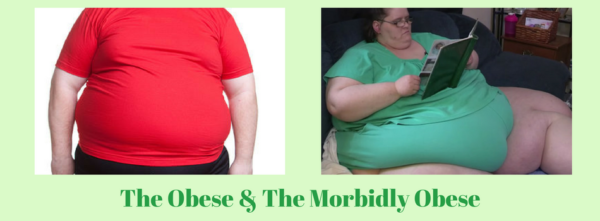 Obesity And Morbid Obesity - Dr M Maran , Springfield Wellness Centre