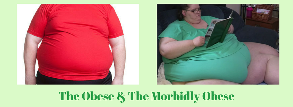 Difference between obesity and morbid obesity