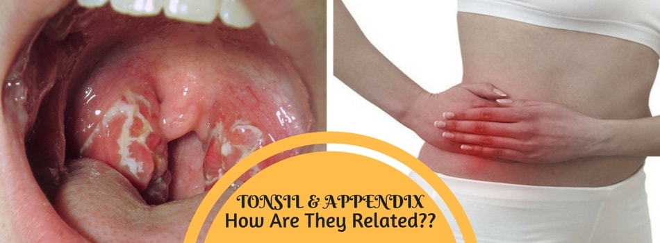 tonsilitis and appendicitis comparison by Dr Maran M