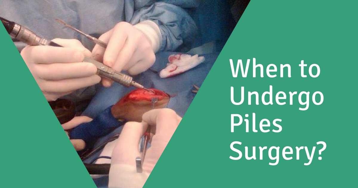 Piles Surgeons performing piles surgery in India. The piles specialist talk about when to get piles surgery done