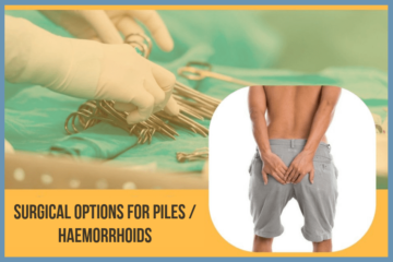 Piles Treatment and Piles Surgery