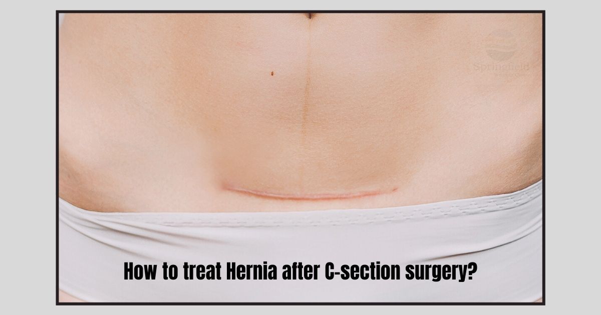 Postpartum Hernia: Understanding The Connection to C-Sections - G & L  Surgical