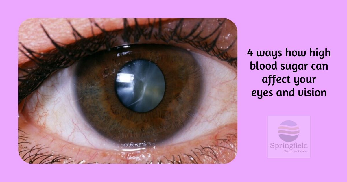 Can High Blood Sugar Affect Eyes