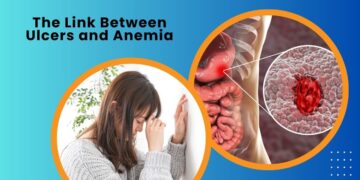 The Link Between Ulcers and Anemia