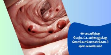 40 வயதிற்கு மேற்பட்டவர்களுக்கு கொலோனோஸ்கோபி ஏன் அவசியம்?