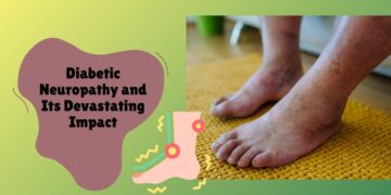 Diabetic Neuropathy and Its Devastating Impact