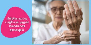 நீரிழிவு நரம்பு பாதிப்பும் அதன் மோசமான தாக்கமும்